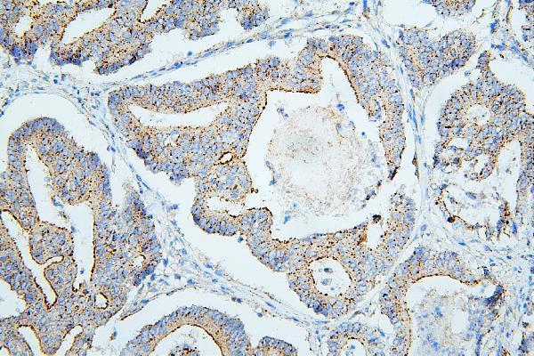 m01751 1 pdcd6ip primary antibodies ihc testing 4