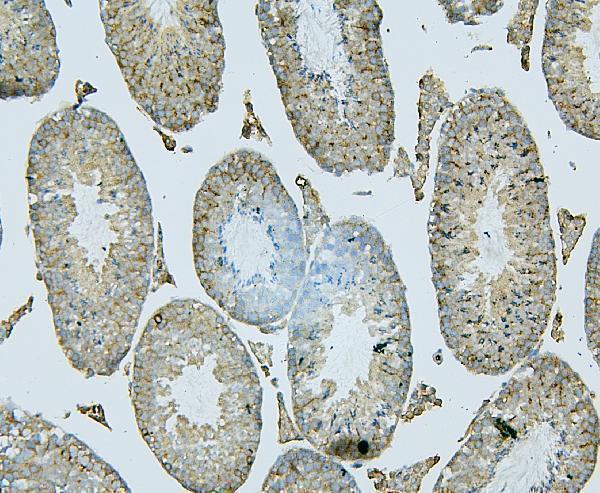 m01751 1 pdcd6ip primary antibodies ihc testing 5