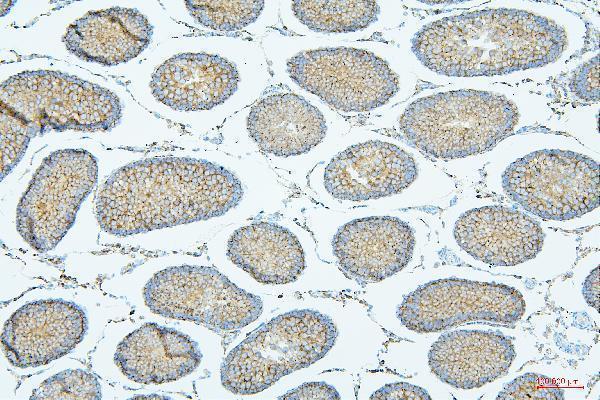 m01751 1 pdcd6ip primary antibodies ihc testing 6