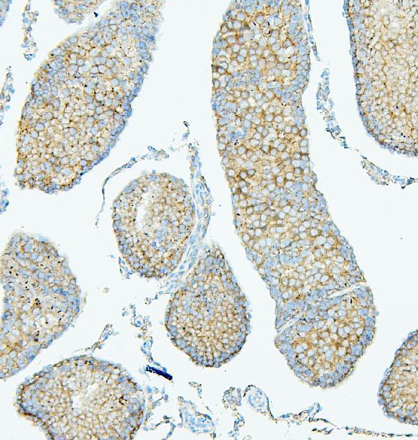 m01751 1 pdcd6ip primary antibodies ihc testing 7_1