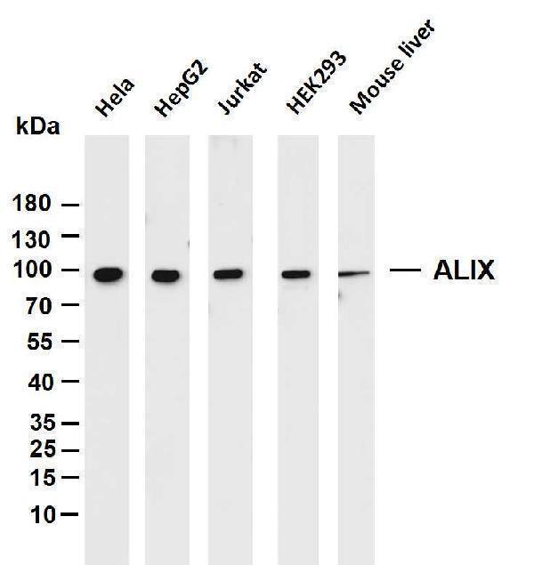 Various whole cell lysates were separated by 4-20% SDS-PAGE, and the membrane was blotted with anti-ALIX antibody