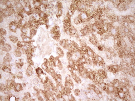 m01752 anti sfrp2 mouse monoclonal antibody clone id oti6c2 ihc testing 5