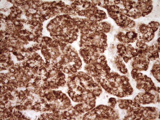m01752 anti sfrp2 mouse monoclonal antibody clone id oti6c2 ihc testing 6