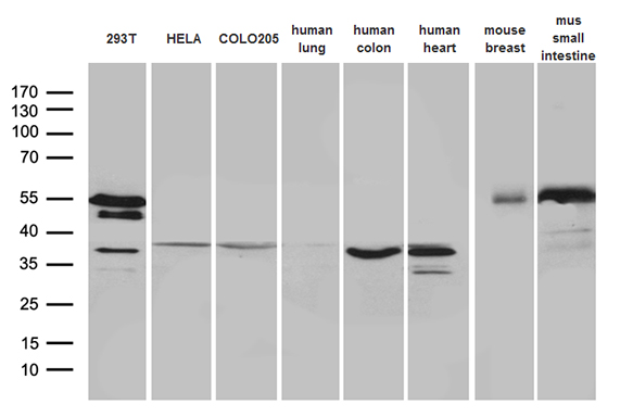 Western blot analysis of extracts (35ug) from 3 different cell lines and 5 different tissue lysates by using anti-SFRP2 monoclonal antibody (1:500)