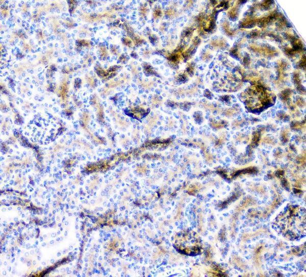 m01756 cd2ap primary antibodies ihc testing 11