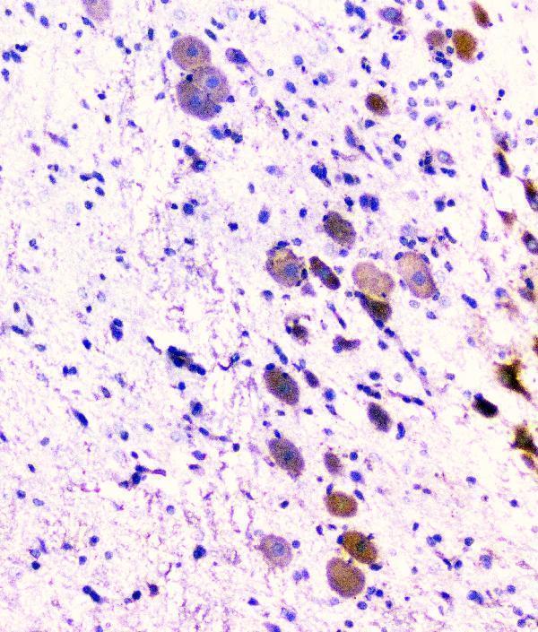 m01756 cd2ap primary antibodies ihc testing 12_1