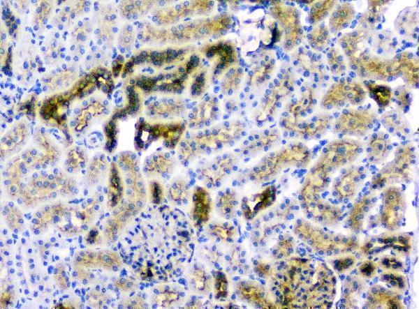 m01756 cd2ap primary antibodies ihc testing 13