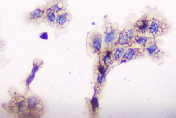 m01756 cd2ap primary antibodies ihc testing 14