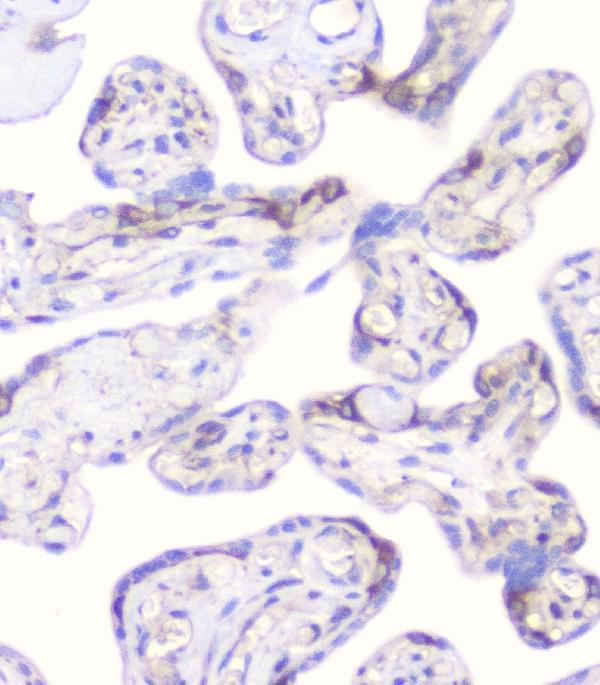 m01756 cd2ap primary antibodies ihc testing 4