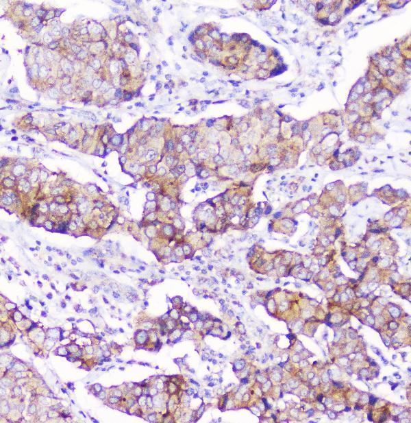 m01756 cd2ap primary antibodies ihc testing 5