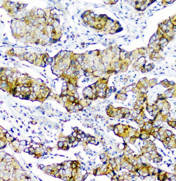 m01756 cd2ap primary antibodies ihc testing 7