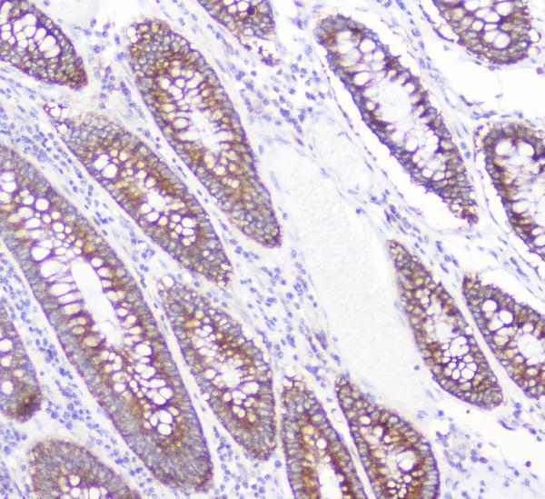 m01756 cd2ap primary antibodies ihc testing 8