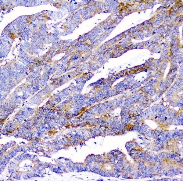 m01756 cd2ap primary antibodies ihc testing 9