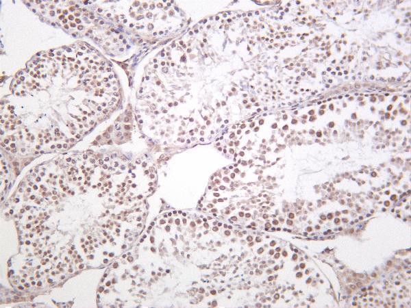 Mouse testis was stained with Anti-METTL3 rabbit antibody