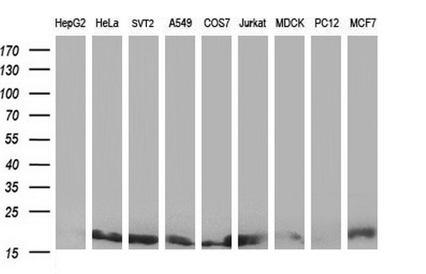 m01762 anti nme2 mouse monoclonal antibody clone id oti2f9 wb testing 2