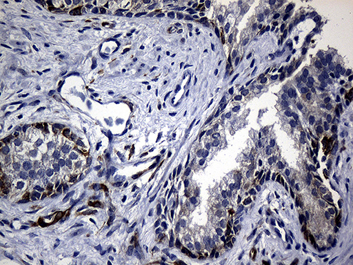 Immunohistochemical staining of paraffin-embedded Human prostate tissue within the normal limits using anti-RRM1 mouse monoclonal antibody