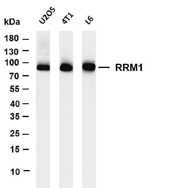Various whole cell lysates were separated by 4-20% SDS-PAGE, and the membrane was blotted with anti-RRM1 antibody