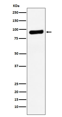 Western blot analysis of RRM1 expression in A549 cell lysate