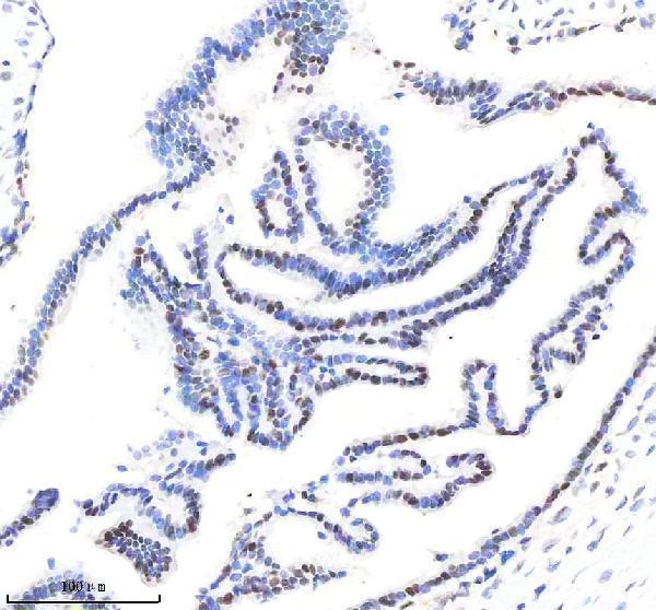  IHC analysis of OCT1/POU2F1 using anti-OCT1/POU2F1 antibody (M01766-1) 
