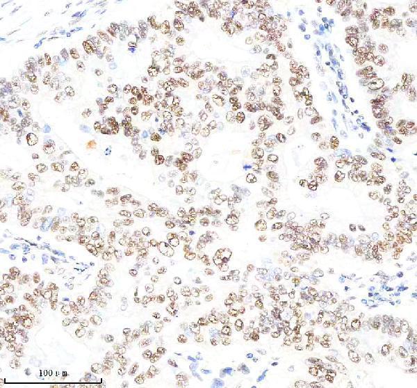  IHC analysis of OCT1/POU2F1 using anti-OCT1/POU2F1 antibody (M01766-1) 