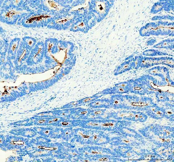  IHC analysis of CD133 using anti-CD133 antibody (M01767-5)