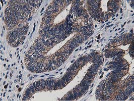 m01768 1 anti apg3 atg3 mouse monoclonal antibody clone id oti2c12 ihc testing 7