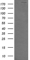 HEK293T cells were transfected with the pCMV6-ENTRY control (Left lane) or pCMV6-ENTRY DOCK8 (Right lane) cDNA for 48 hrs and lysed