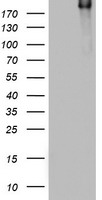 HEK293T cells were transfected with the pCMV6-ENTRY control (Left lane) or pCMV6-ENTRY DOCK8 (Right lane) cDNA for 48 hrs and lysed