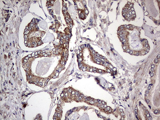 m01771 anti dock8 mouse monoclonal antibody clone id oti4h10 ihc testing 11
