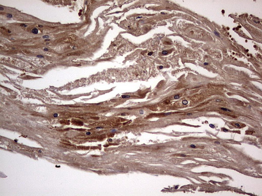 m01771 anti dock8 mouse monoclonal antibody clone id oti4h10 ihc testing 14