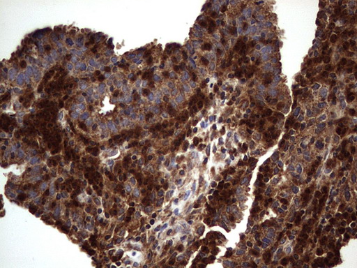 m01771 anti dock8 mouse monoclonal antibody clone id oti4h10 ihc testing 15