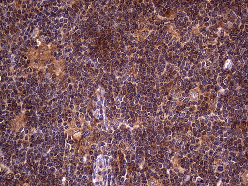 m01771 anti dock8 mouse monoclonal antibody clone id oti4h10 ihc testing 16