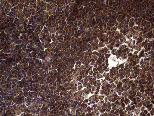 m01771 anti dock8 mouse monoclonal antibody clone id oti4h10 ihc testing 17