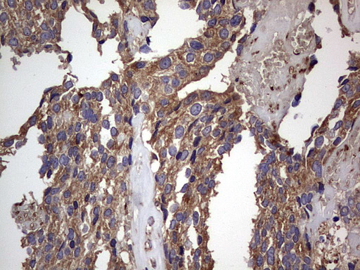 m01771 anti dock8 mouse monoclonal antibody clone id oti4h10 ihc testing 18
