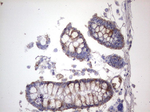 m01771 anti dock8 mouse monoclonal antibody clone id oti4h10 ihc testing 19