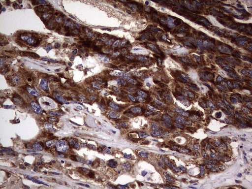 m01771 anti dock8 mouse monoclonal antibody clone id oti4h10 ihc testing 20