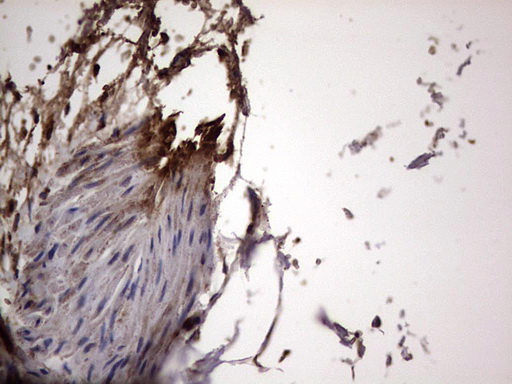 m01771 anti dock8 mouse monoclonal antibody clone id oti4h10 ihc testing 22
