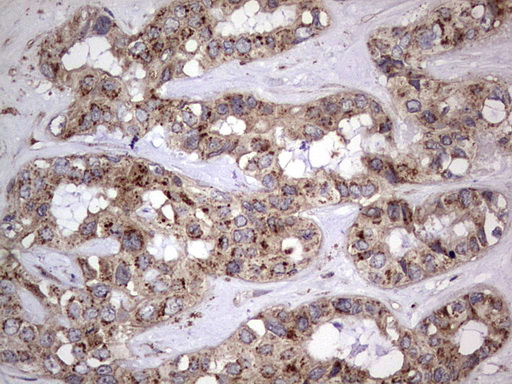 m01771 anti dock8 mouse monoclonal antibody clone id oti4h10 ihc testing 24