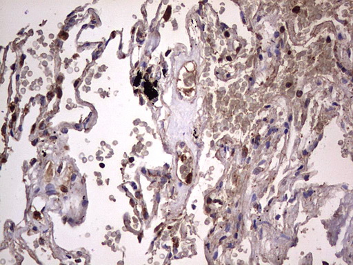 m01771 anti dock8 mouse monoclonal antibody clone id oti4h10 ihc testing 25