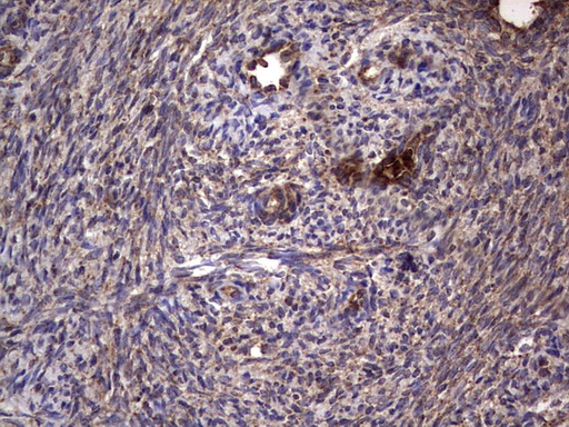 Immunohistochemical staining of paraffin-embedded Human Ovary tissue within the normal limits using anti-DOCK8 mouse monoclonal antibody
