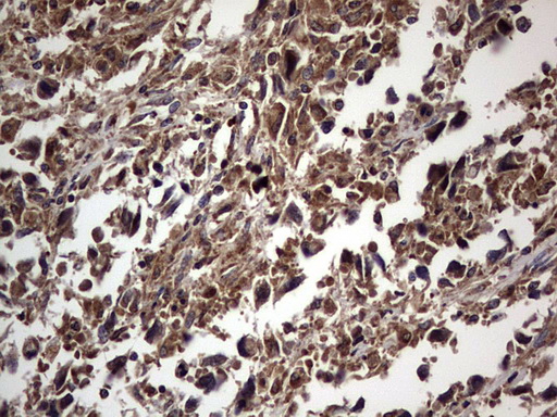 m01771 anti dock8 mouse monoclonal antibody clone id oti4h10 ihc testing 4