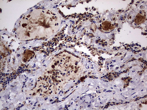 m01771 anti dock8 mouse monoclonal antibody clone id oti4h10 ihc testing 7