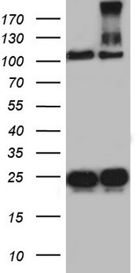 HEK293T cells were transfected with the pCMV6-ENTRY control (Left lane) or pCMV6-ENTRY DOCK8 (Right lane) cDNA for 48 hrs and lysed