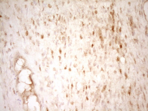 m01775 anti thyroid hormone receptor alpha thra mouse monoclonal antibody clone id oti2a2 ihc testing 3
