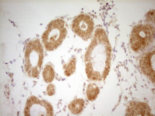 m01775 anti thyroid hormone receptor alpha thra mouse monoclonal antibody clone id oti2a2 ihc testing 4