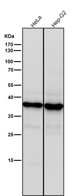 All lanes use the Antibody at 1:1K dilution for 1 hour at room temperature