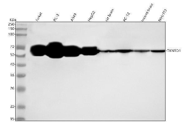  Western blot analysis of TXNRD1 using anti-TXNRD1 antibody (M01778)