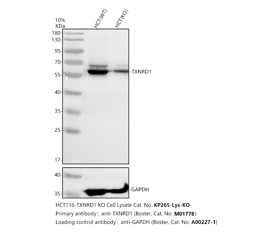 Western blot analysis of TXNRD1 using anti-TXNRD1 antibody (M01778)