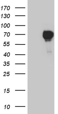 HEK293T cells were transfected with the pCMV6-ENTRY control (Left lane) or pCMV6-ENTRY FOXC2 (Right lane) cDNA for 48 hrs and lysed