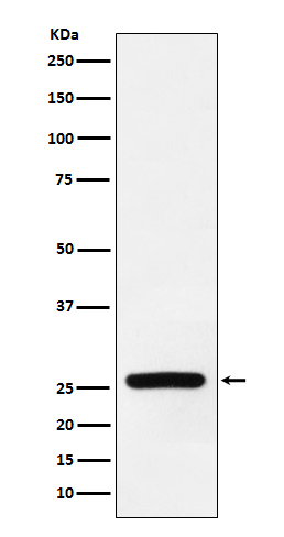 Western blot analysis of Superoxide Dismutase 3 expression in human fetal heart lysate